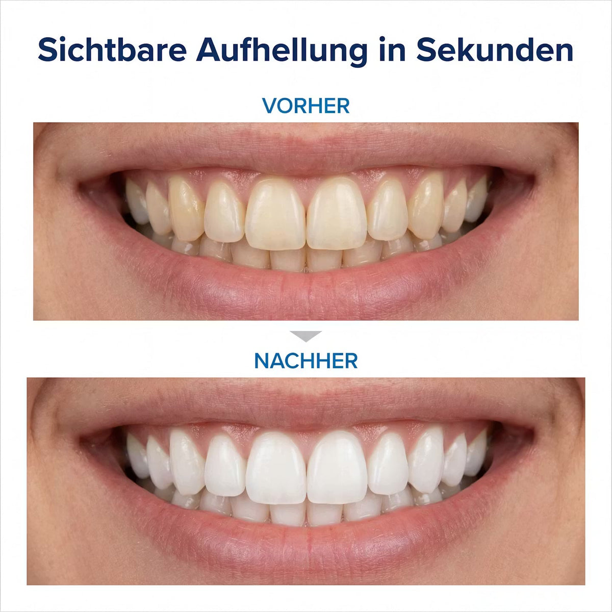 VioletGlow Pen V34 – Zahnpflegestift – Produktansicht 14