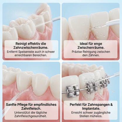 SonicSmile Pro – Zahnbürste & Munddusche – Produktansicht 5