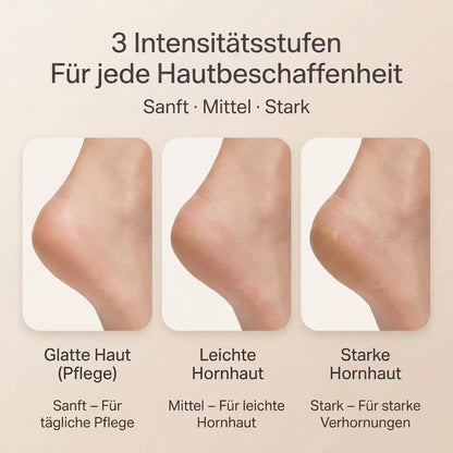 SilkStep – Elektrischer Hornhautentferner – Produktansicht 5