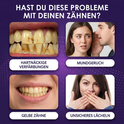 VioletGlow Pen V34 – Zahnpflegestift – Produktansicht 9