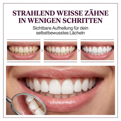 VioletGlow V34 – Zahnpasta – Produktansicht 14