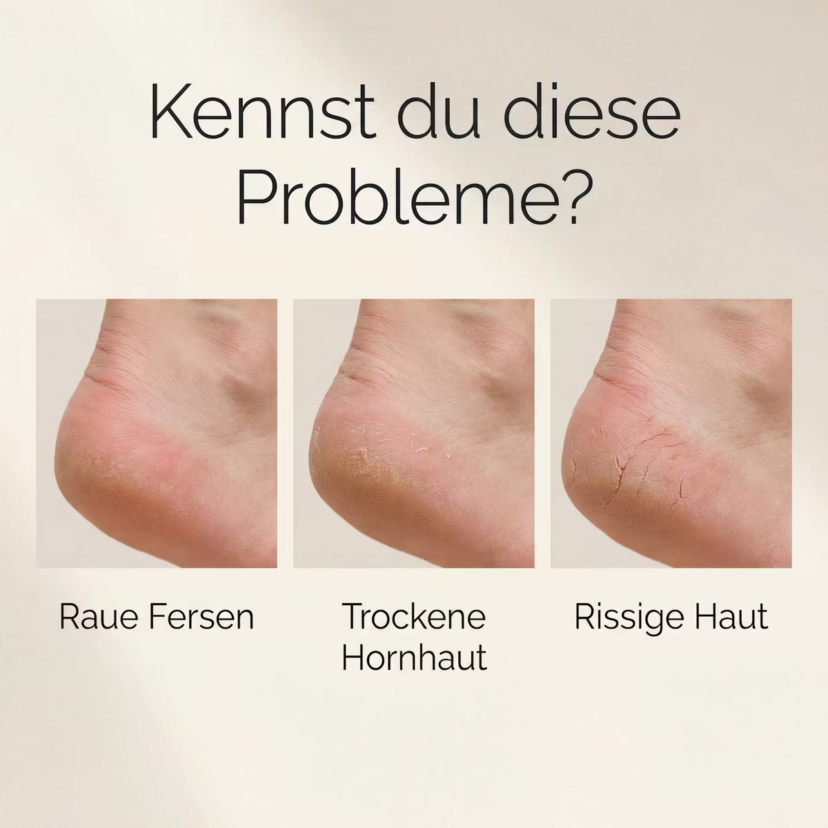 SilkStep – Elektrischer Hornhautentferner – Produktansicht 4