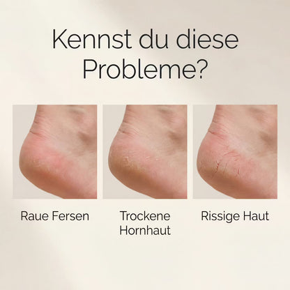 SilkStep – Elektrischer Hornhautentferner – Produktansicht 4